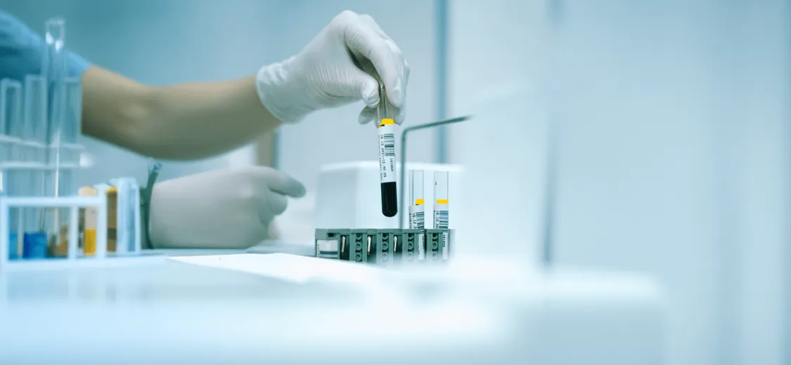 Diagnostic de laboratoire & analyse médicale